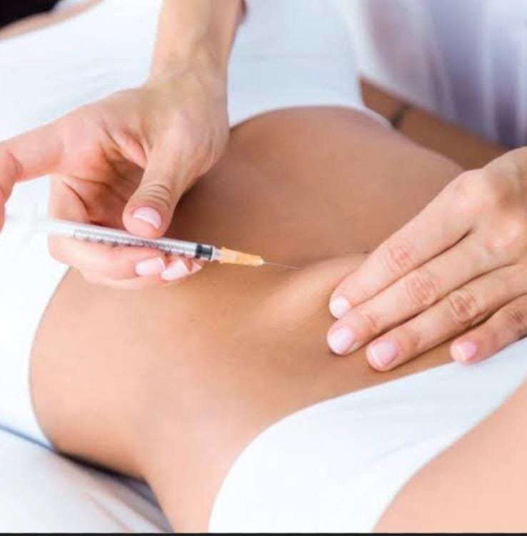Mesoterapia